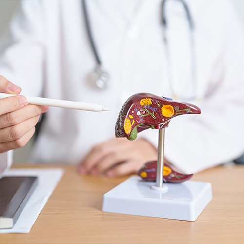 Fatty Liver Treatment in Ongole