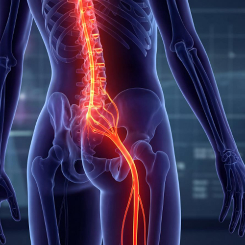 Sciatica & Peripheral Nerve Treatment in Ongole