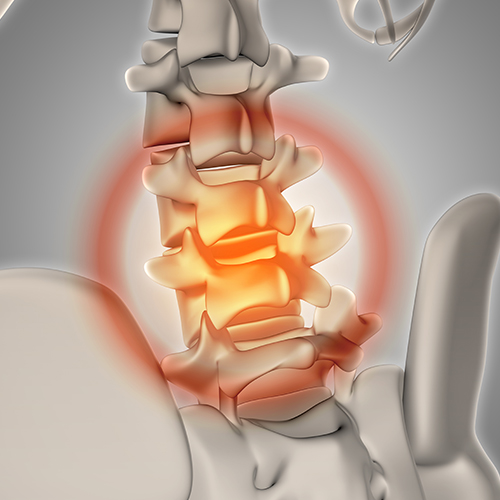 Spine Disorder treatment in Ongole