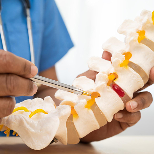 Spine Tumor Surgery in Ongole